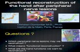 Hand Nerve Reconstruction[1]