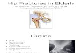 Hip Fractures in Elderly - Shanojan Thiyagalingam