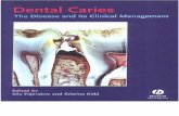 Dental Caries [Ole Fejerskov, Edwina Kidd]