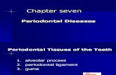 23476208 Periodontal Diseases