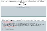 17 - Developmental Dysplasia of the Hip - D3