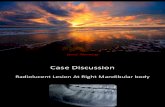 Case discussion for radiolucent lesion at body and angle of mandible