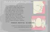 Space Closure3 / orthodontic courses by Indian dental academy