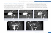 GEHealthcare-Publication Clinical Value Musculoskeletal Imaging Nov 2011
