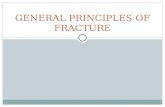 General Principles of Fracture