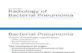 Radiology of bacterial pneumonia