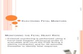1156Electronic Fetal Monitors