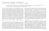 1990 - Slife - Pulmonary Arterial Compliance at Rest and Exercise in Normal Humans