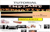 Implant Dermatitis. Tutorial.