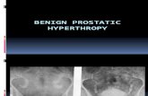 Benign Prostatic Hyperthropy