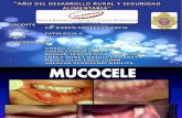 Mucocele Expo[1]
