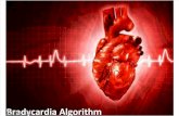 Bradycardia Algorithm