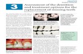 Assessment of the Dentition and Treatment Options for the Replacement of Missing Teeth