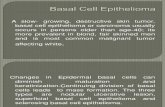 Basal Cell Epithelioma2