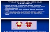 What is Spinal Muscle Atrophy