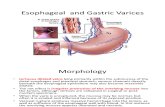 Esophageal and Gastric Varices
