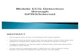 Mobile ECG Detection through