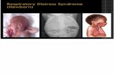 Respiratory Distress Syndrome (Newborn)