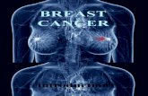 001 Breast Cancer Presentation