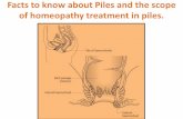 Facts to know about piles and the scope of homeopathy treatment in piles