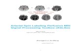 Arterial Spin Labeling Perfusion MRI Signal Processing Toolbox ...