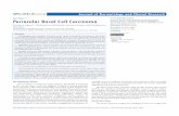 Periocular Basal Cell Carcinoma