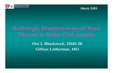 Radiologic Manifestations of Bone Disease in Sickle Cell Anemia
