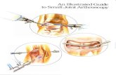 Page 1 An Illustrated Guide to Small Joint Arthroscopy Page 2 Page ...