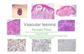 Vascular Lesions – Dr Komala Pillay