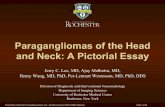 Paragangliomas of the Head and Neck: A Pictorial Essay