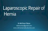 Laparoscopic repair of hernia- A Guide to Laparoscopic Hernia Surgery