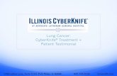 Illinois CyberKnife: Lung Cancer Patient