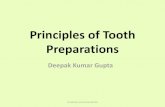 Principles of tooth preparations