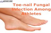 Toenail  fungal infection among athletes