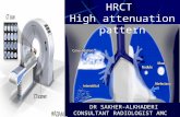 HRCT High attenuation pattern