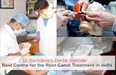 best root canal treatment clinic in delhi