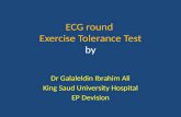 ECG  Exercise Tolerance  Test