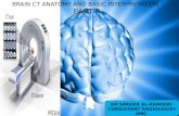 Brain CT Anatomy and Basic Interpretation Part II