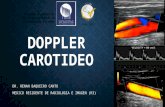 Doppler carotideo