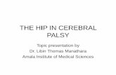 The hip in cerebral palsy  part 2 of 2