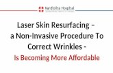 Laser Skin Resurfacing – a Non-Invasive Procedure To Correct Wrinkles – Is Becoming More Affordable