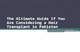 The Ultimate Guide If You Are Considering a Hair Transplant in Pakistan