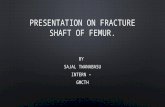 Presentation on fracture shaft of femur