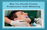 Why You Should Choose Professional Teeth Whitening