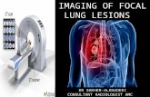 Imaging of Focal Lung Lesions