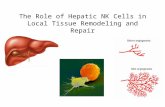 The Role of Hepatic NK Cells in Local Tissue Remodeling and Repair
