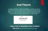 Anal fissure and homeopathy treatment