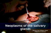 Neoplacias de las glandulas salivales