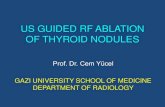 US guided thyroid ablation