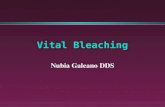 Bleaching-teeth//nubia galeano
